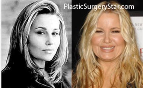 jennifer coolidge before surgery|Jennifer Coolidge Plastic Surgery: Fact or Fiction ...